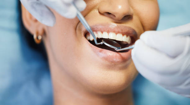 Best After-Hours Dental Trauma Care in Morrisville, VT
